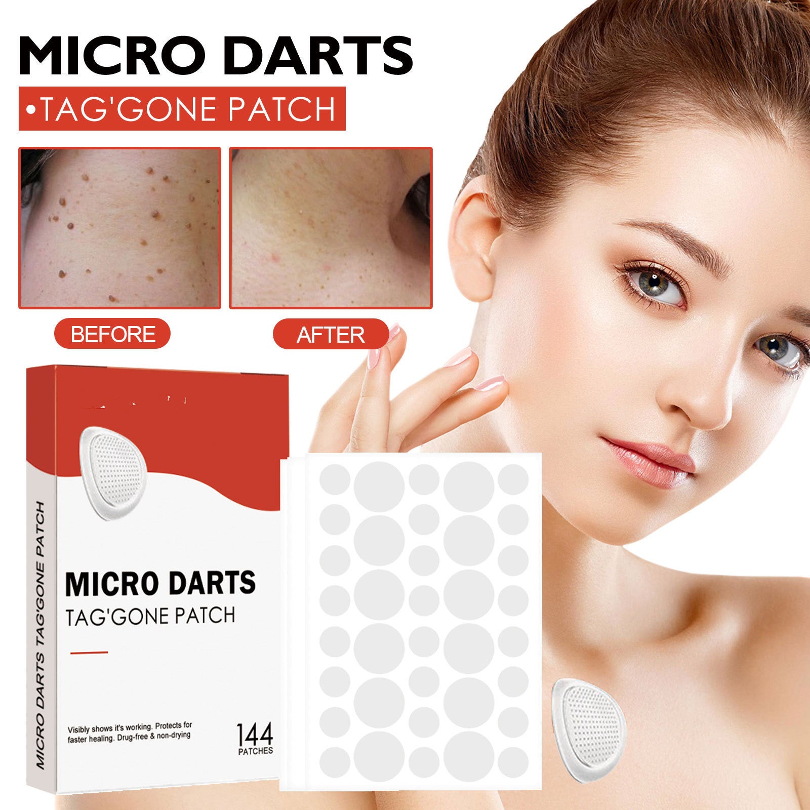 🌙 Acne Spot Patches – Clear & Confident Skin Overnight 🌸