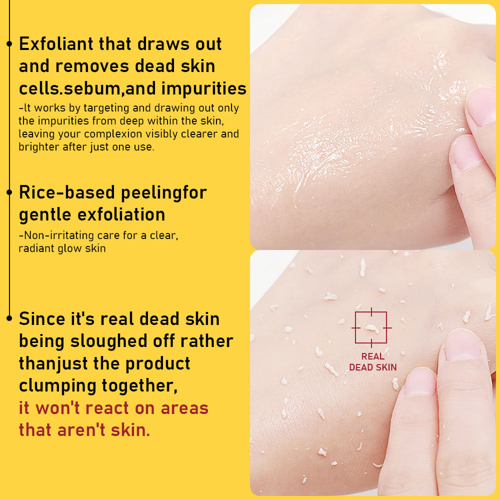 🍍 PHOFAY Gentle Peeling Solution – Papaya Enzyme + AHA & BHA 🌸