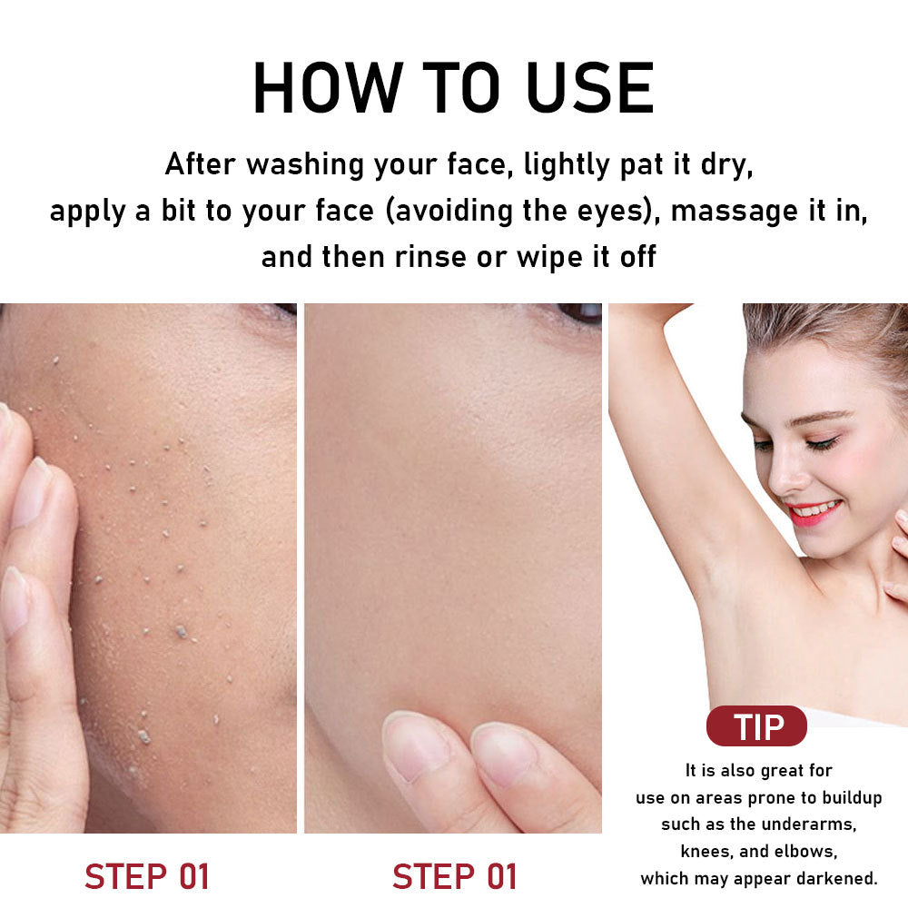 🍍 PHOFAY Gentle Peeling Solution – Papaya Enzyme + AHA & BHA 🌸