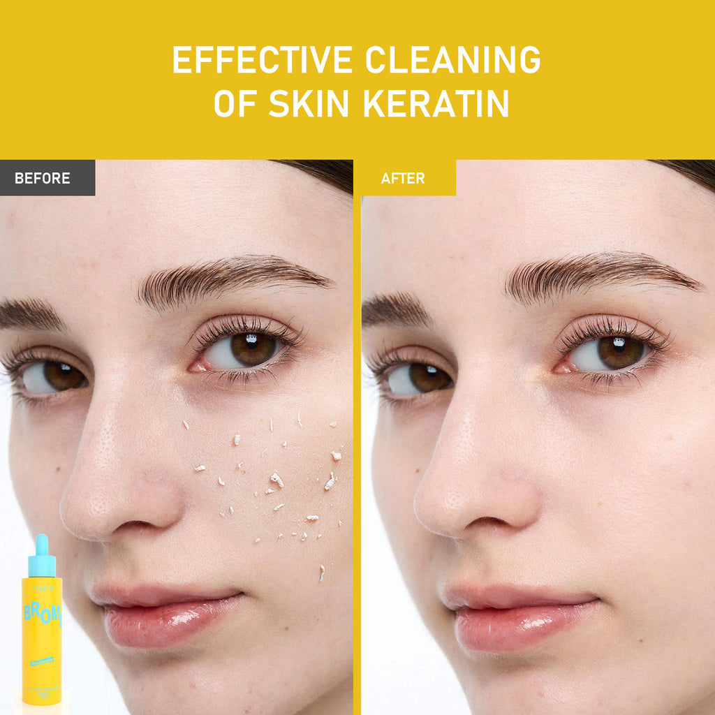 🍍 PHOFAY Gentle Peeling Solution – Papaya Enzyme + AHA & BHA 🌸