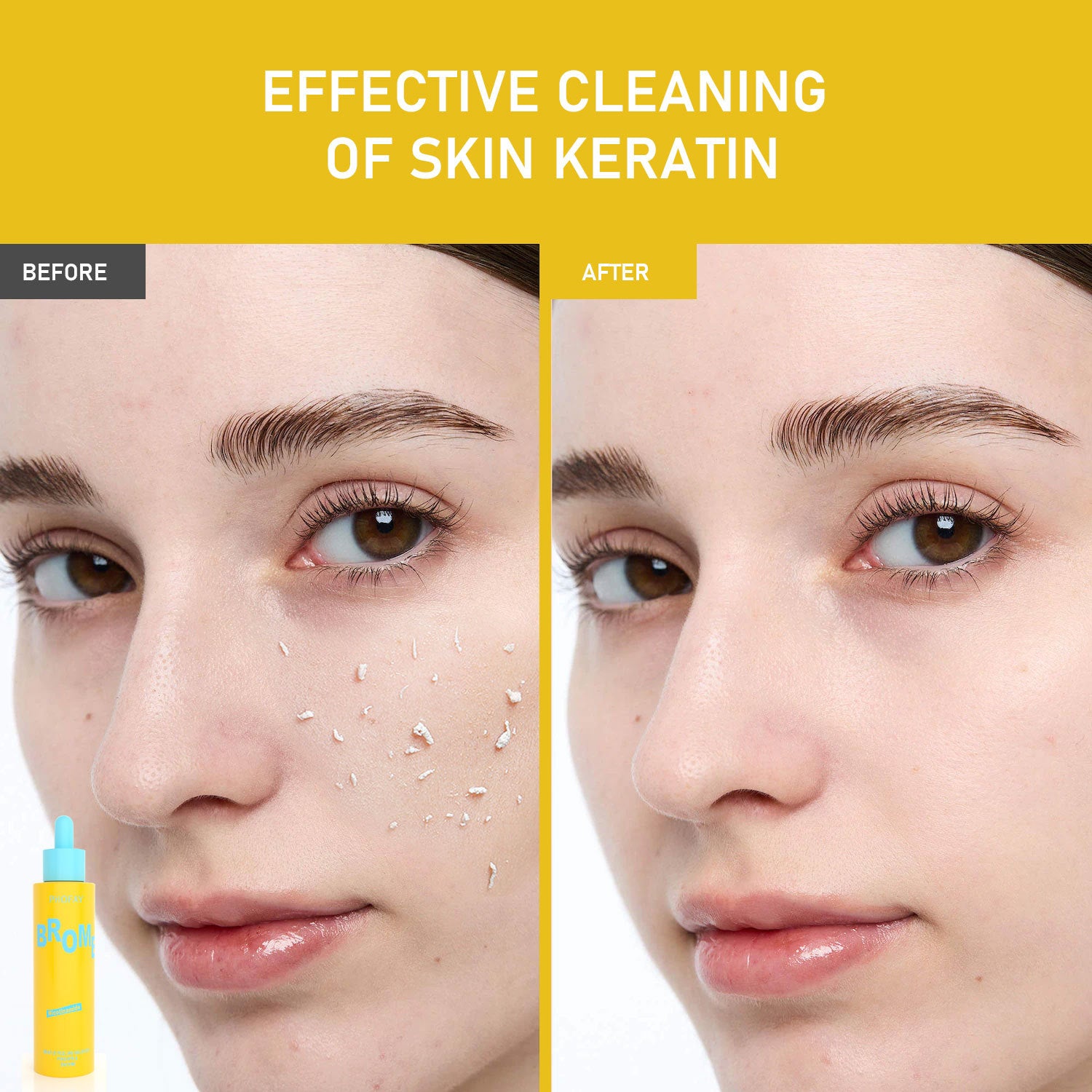 🍍 PHOFAY Gentle Peeling Solution – Papaya Enzyme + AHA & BHA 🌸